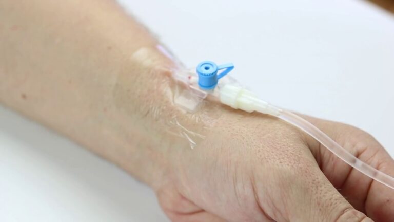 Kroplówka – sposób na kaca